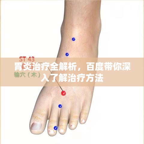 胃炎治疗全解析,百度带你深入了解治疗方法