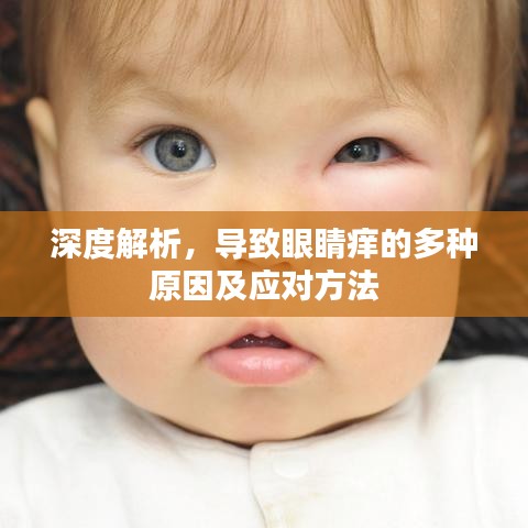 深度解析，导致眼睛痒的多种原因及应对方法